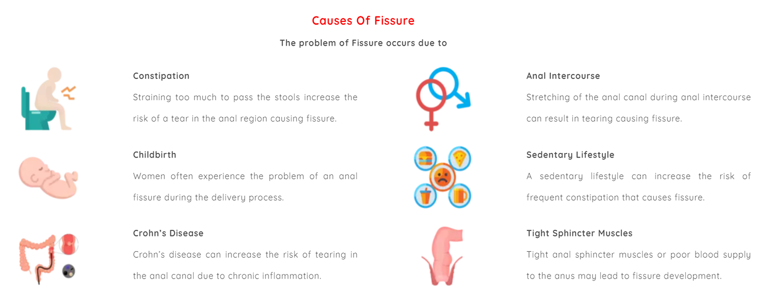 causes of fissure vedhtantra ayurveda supplier producer manufacturera ayurvedic products ahmedabd gujarat india