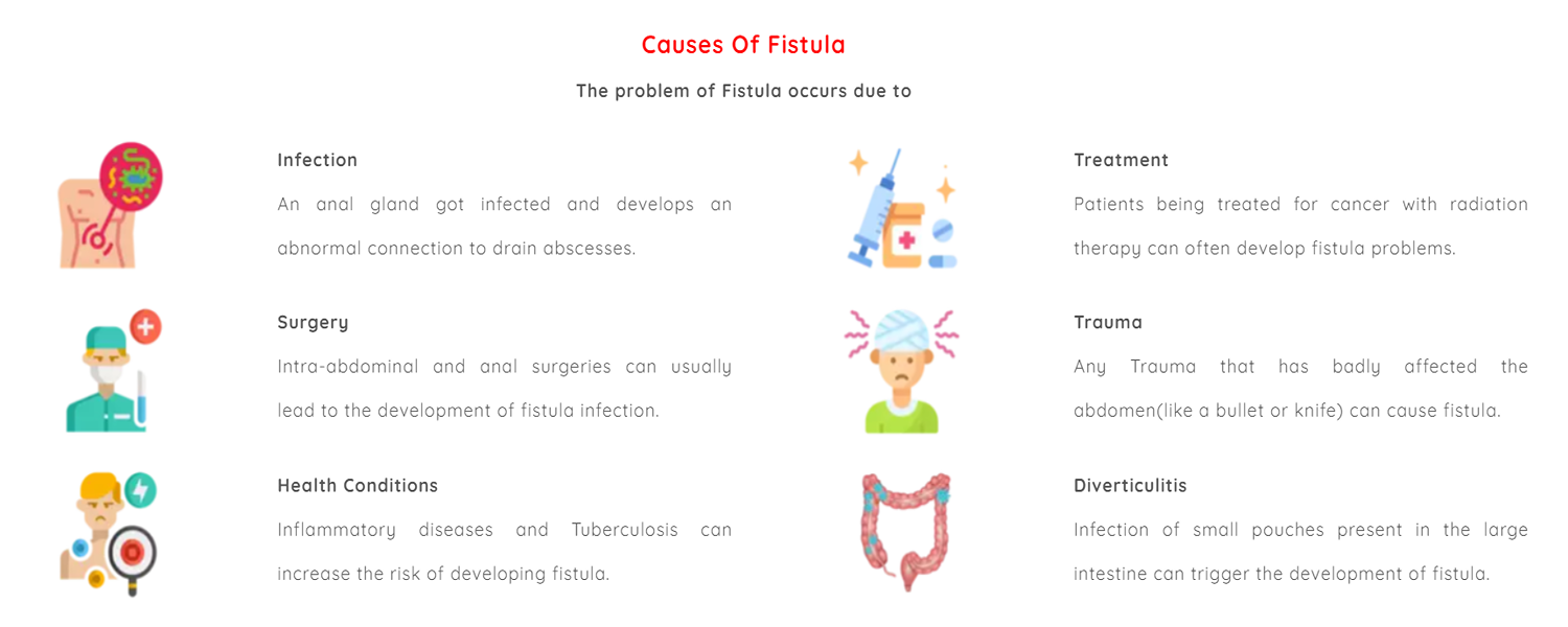 causes of fistula vedhtantra ayurveda supplier producer manufacturera ayurvedic products ahmedabd gujarat india